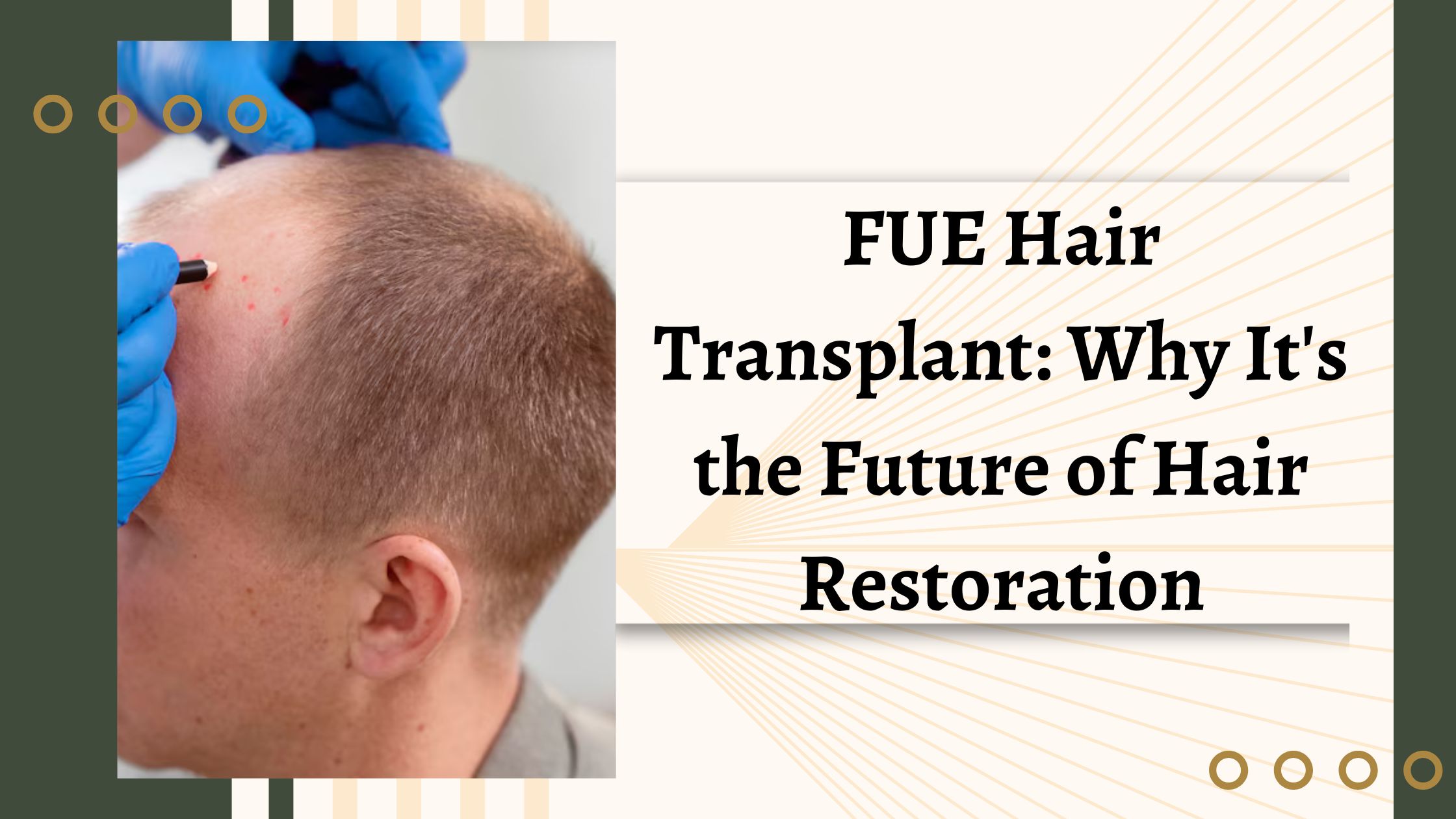 FUE Hair Transplant Why It's the Future of Hair Restoration