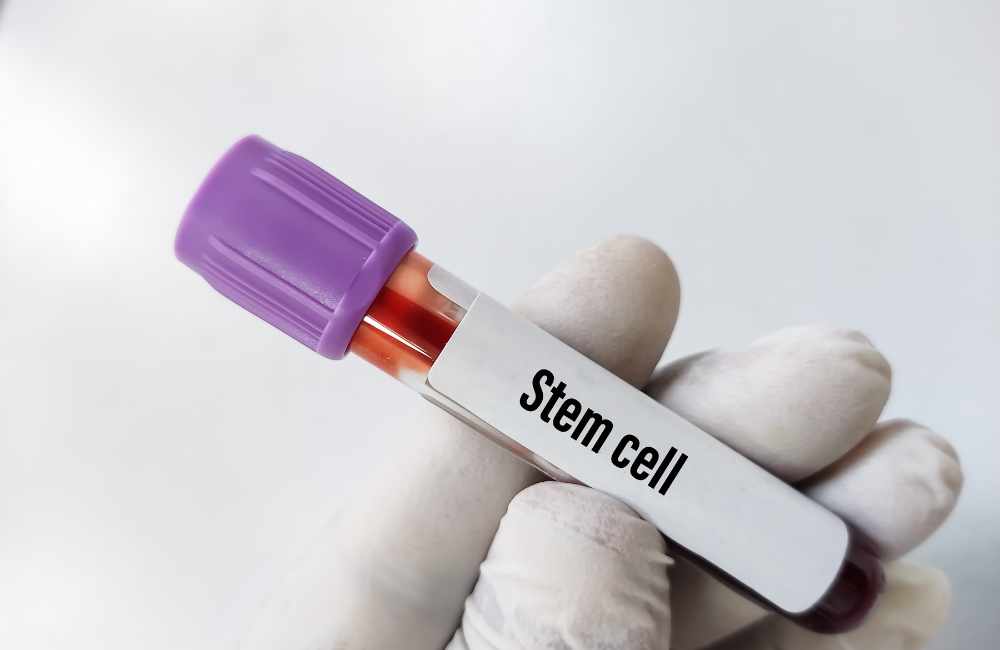 Stem Cell Therapy