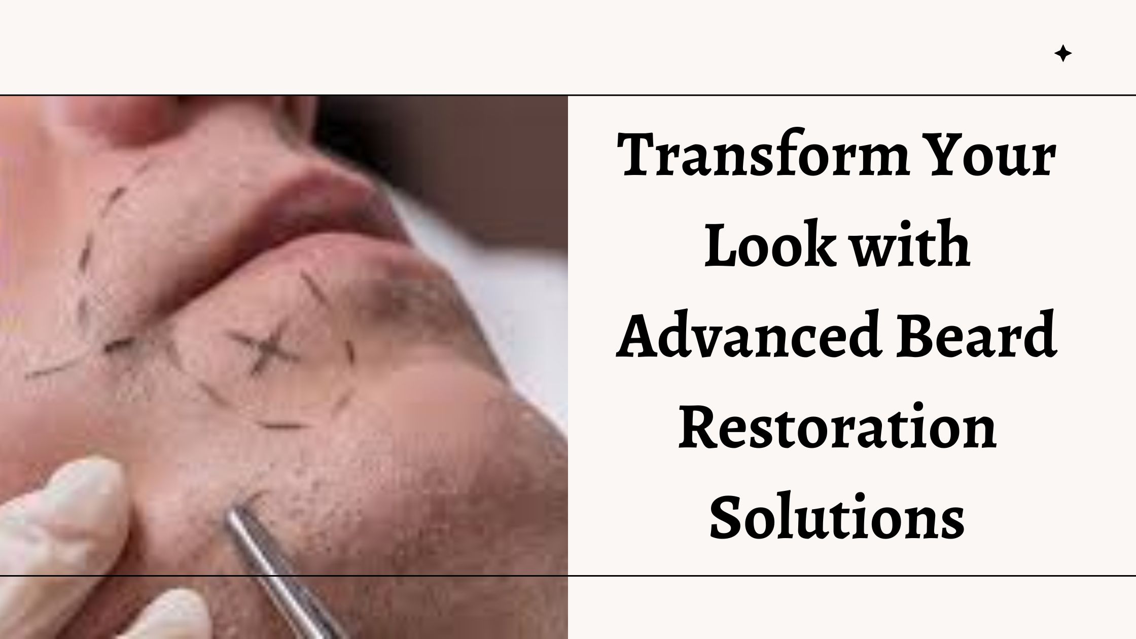 Transform Your Look with Advanced Beard Restoration Solutions