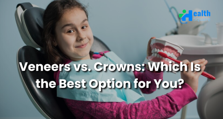 Veneers vs. Crowns Which Is the Best Option for You