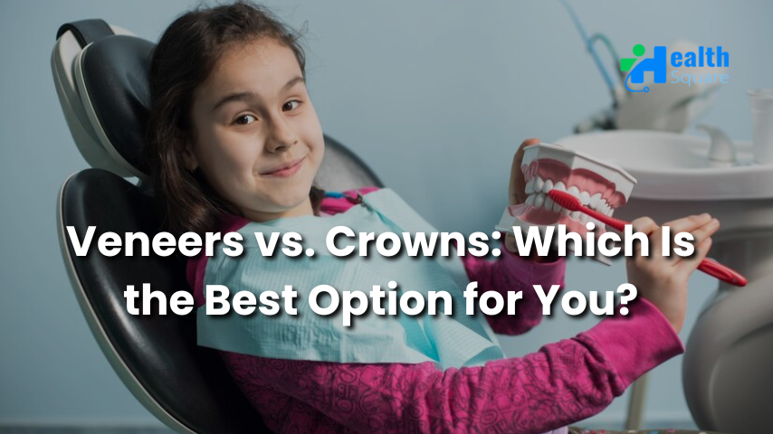 Veneers vs. Crowns Which Is the Best Option for You