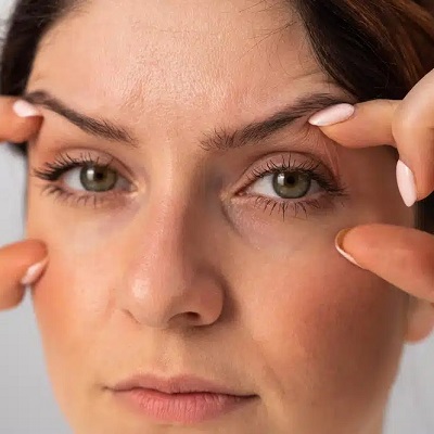 Eyelid Surgery Clinic in Muscat