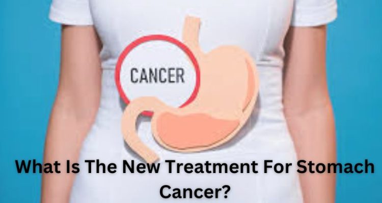 What Is The New Treatment For Stomach Cancer