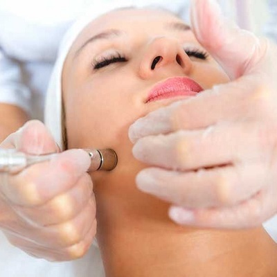 Microdermabrasion Muscat