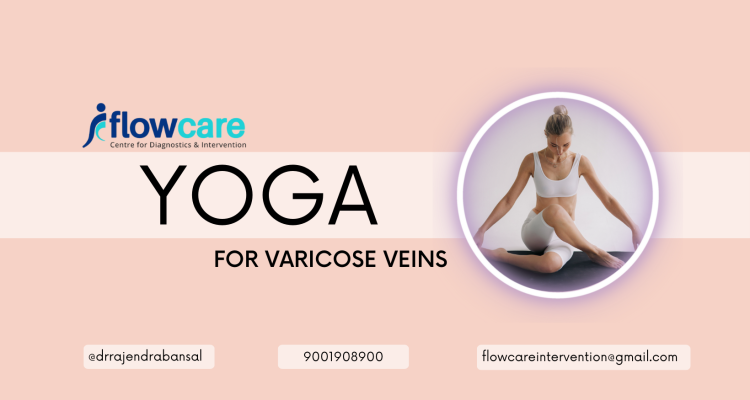 Yoga for varicose veins1