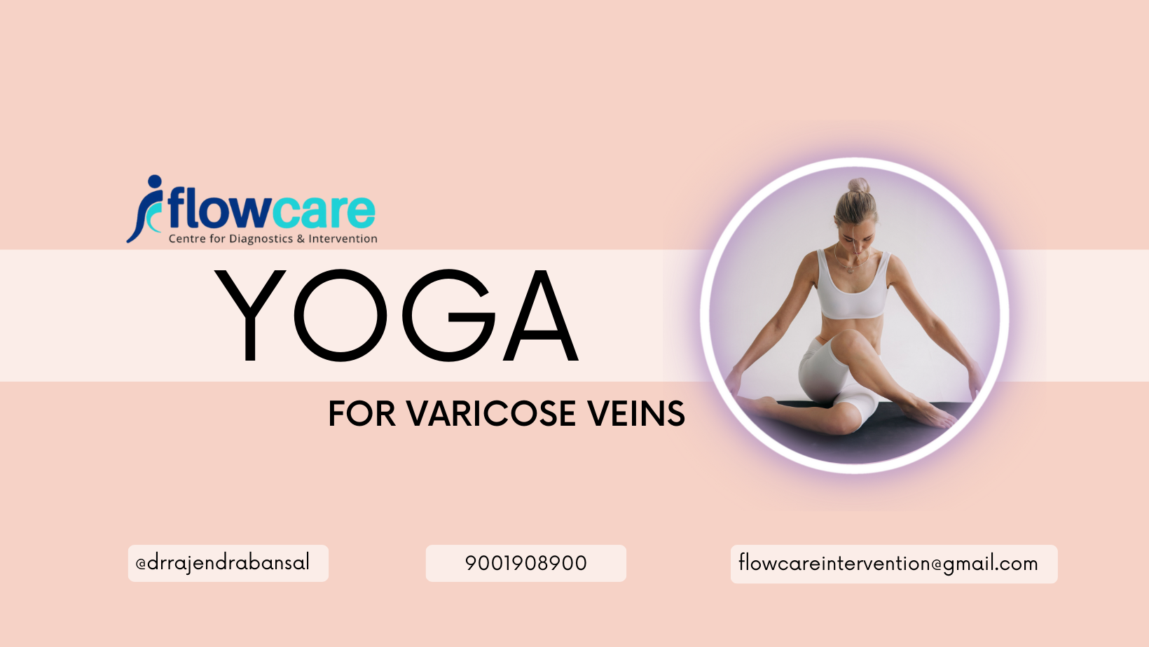 Yoga for varicose veins1