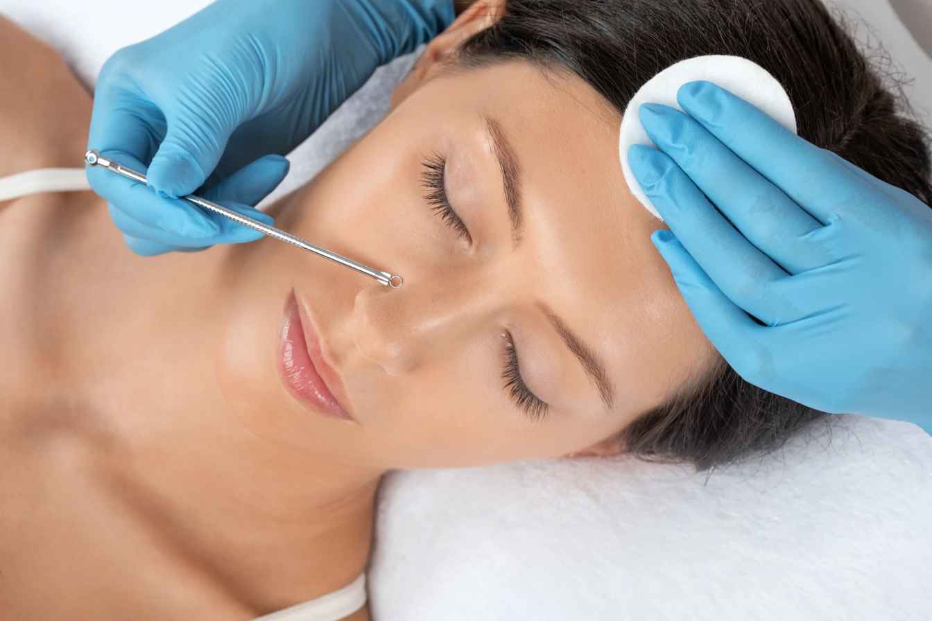 blackhead treatment dermatologist (1)