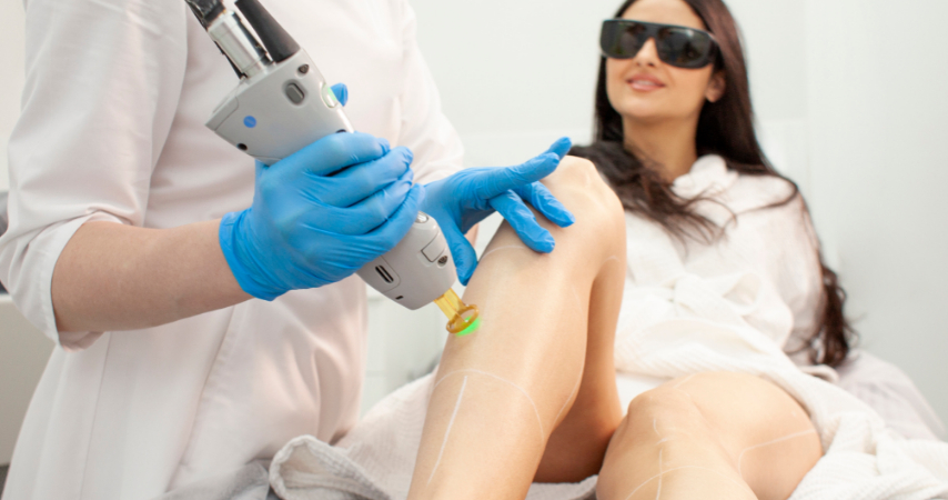 Permanent Hair Removal with LightSheer Laser