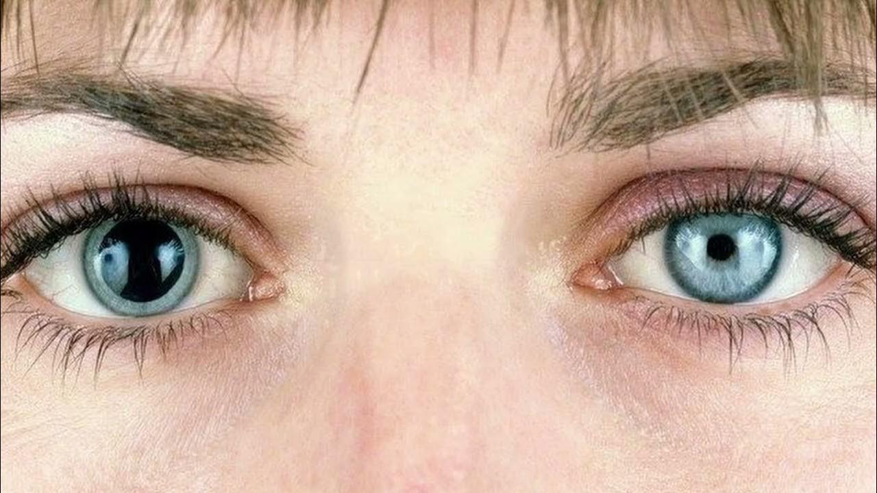 pinpoint pupils