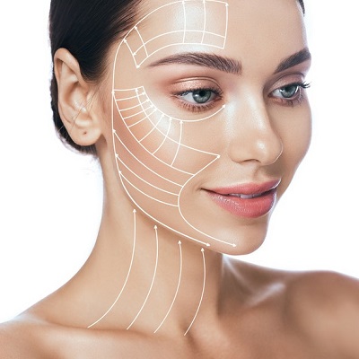 Facelift