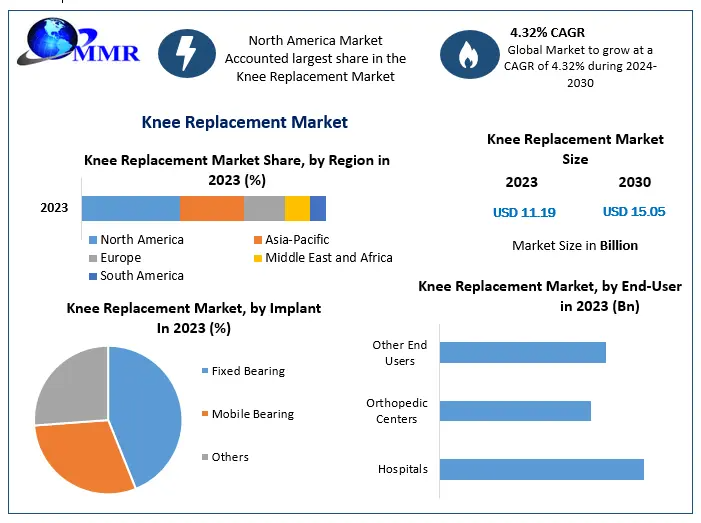 Knee-Replacement-Market-1