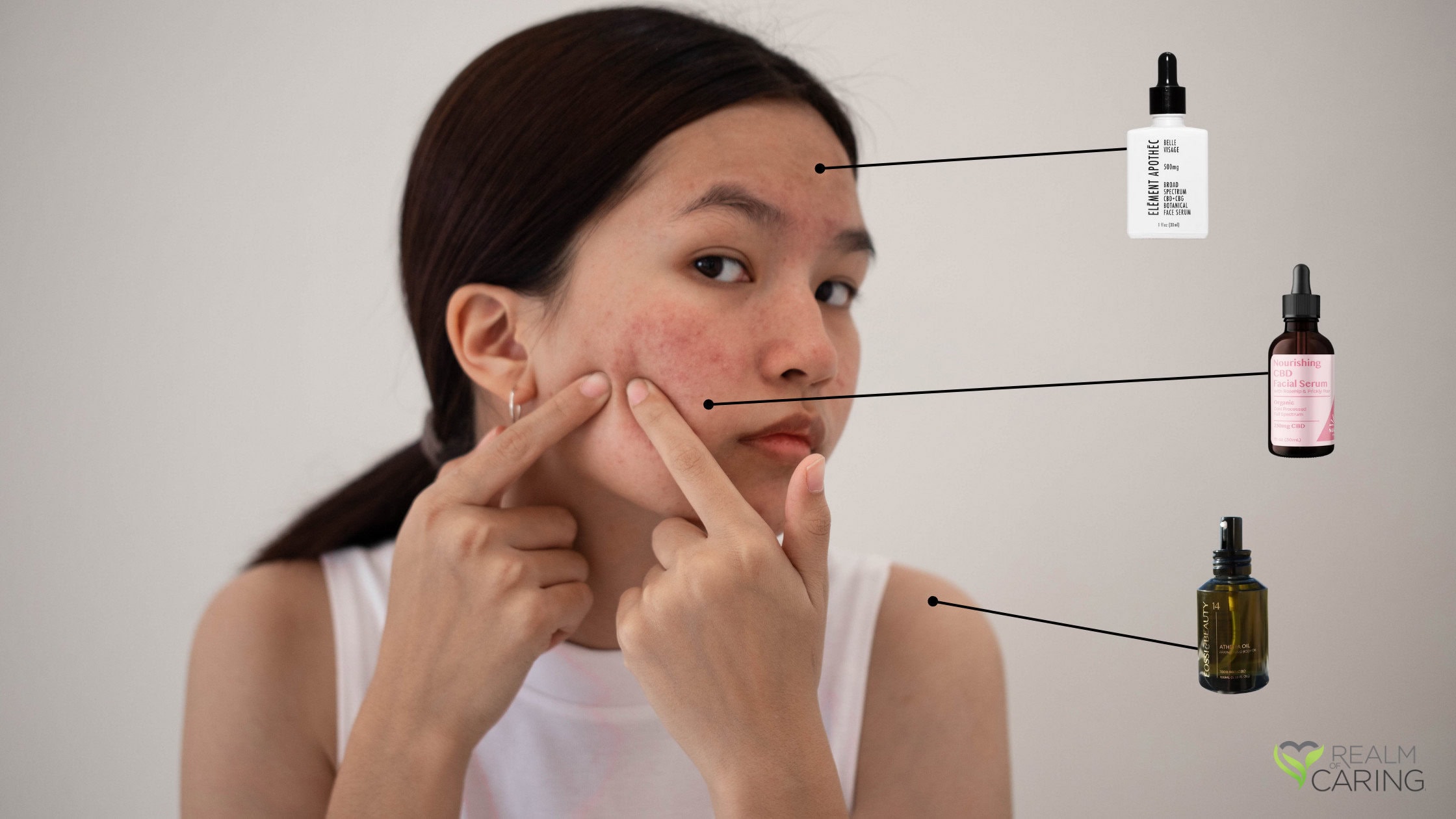 weed acne