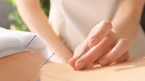 Acupuncture For Hormone Regulation