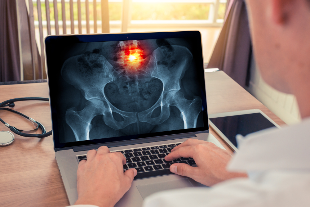 digital x-rays