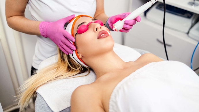 Can Laser Hair Removal Be Done on the Face