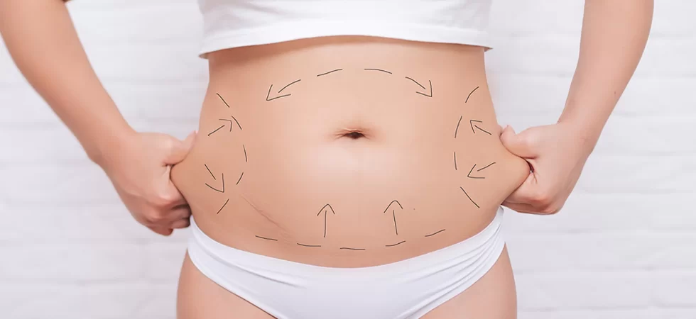 Mini tummy tuck Islamabad