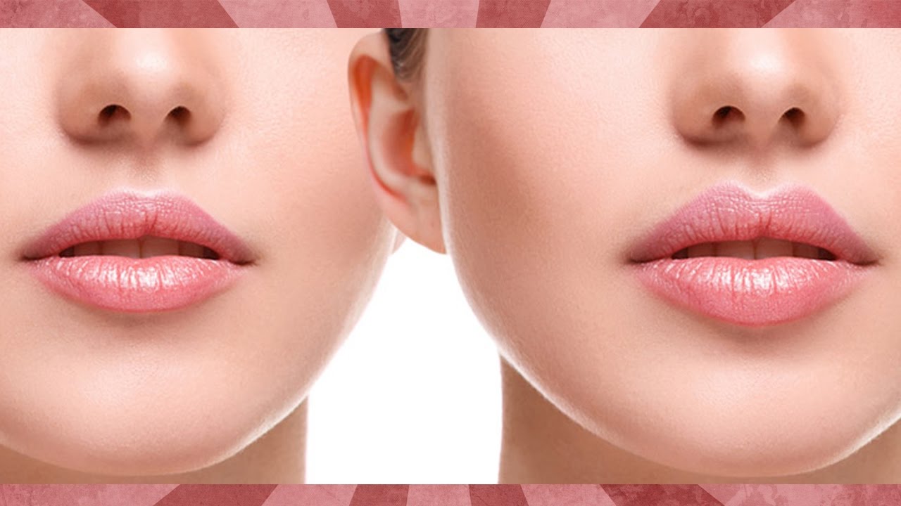 Non-Surgical Lip Enhancement Islamabad