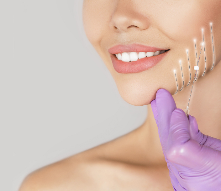 Thread lift for double chin Islamabad