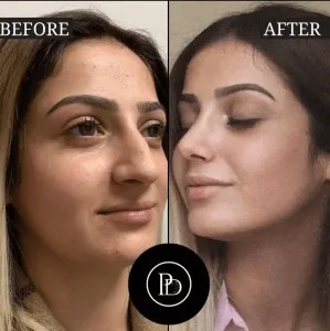 The Future of Beauty is Here: PRP Treatment in Dubai
