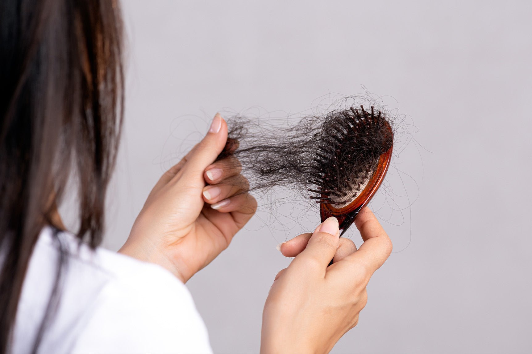 Hair Loss Treatment in Dubai