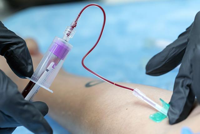 Blood_20draw_20cbc_20ojas_20de_20hojalata_20GettyImages-2169206675
