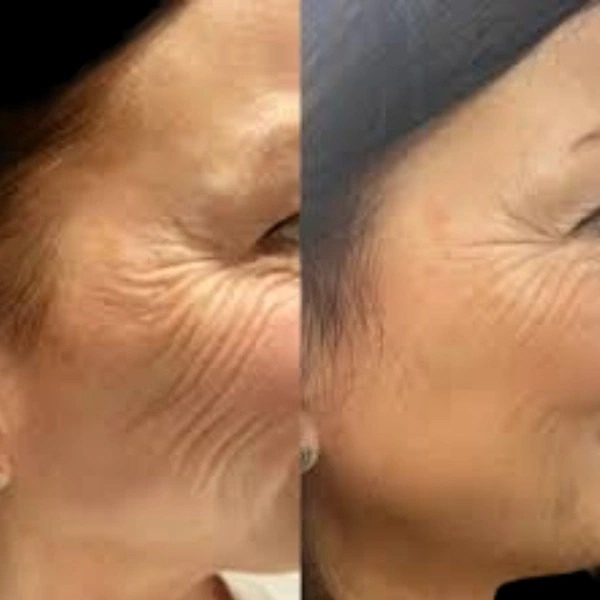 Best Plastic Surgeons in dubai