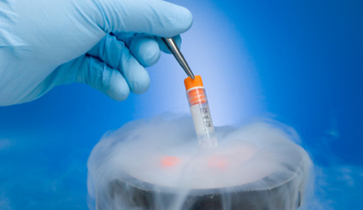 fertility-preservation