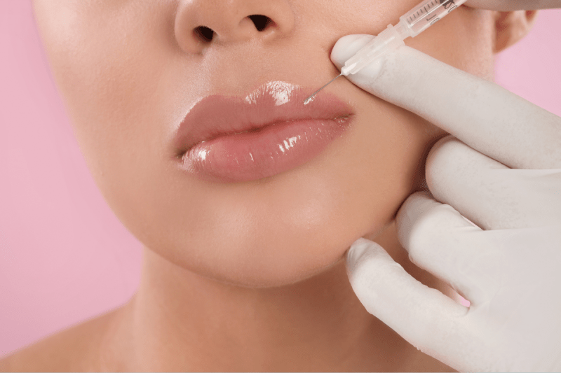 lip-filler