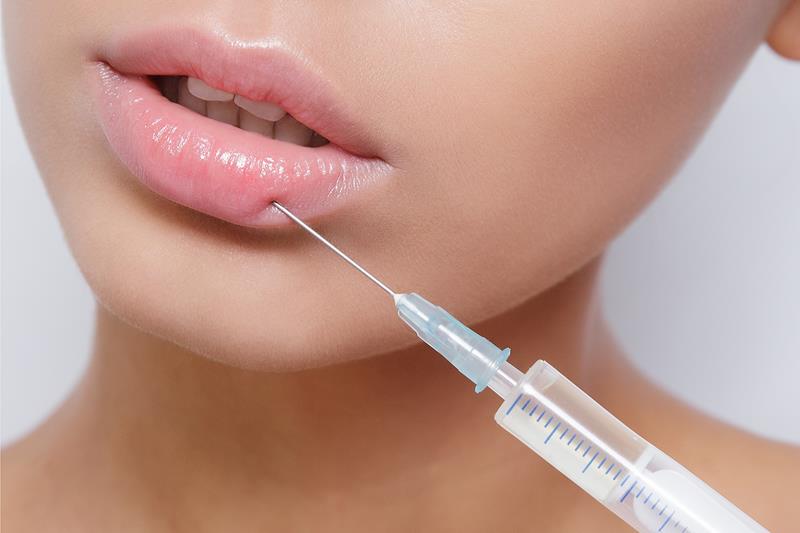 lip fillers vaughan