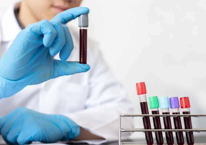 blood_samples.width-700