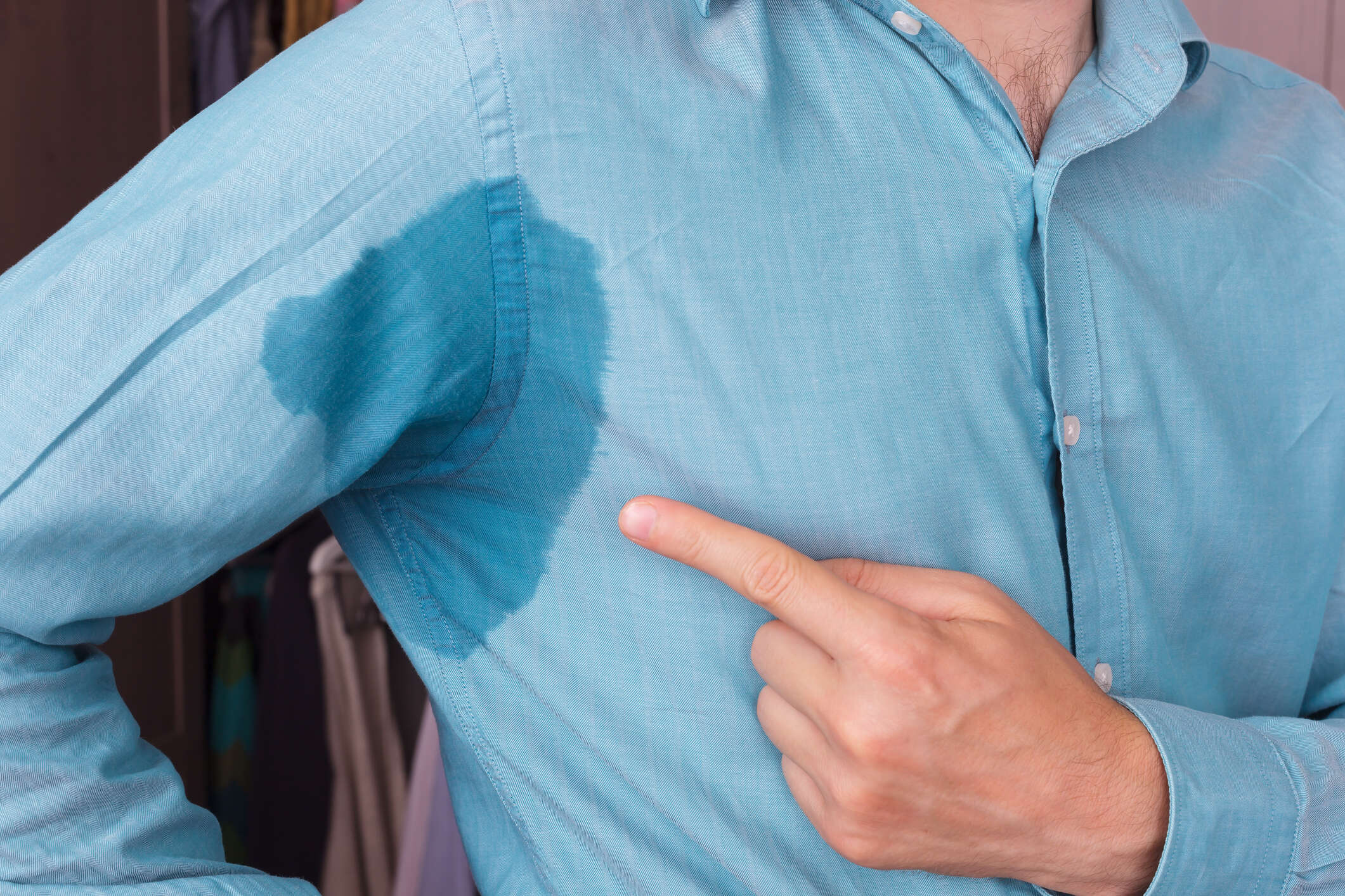 Hyperhidrosis Treatment in Dubai