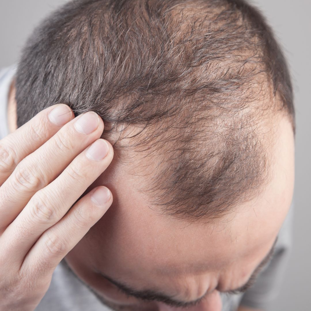 How long before results appear after PRP or mesotherapy in Dubai