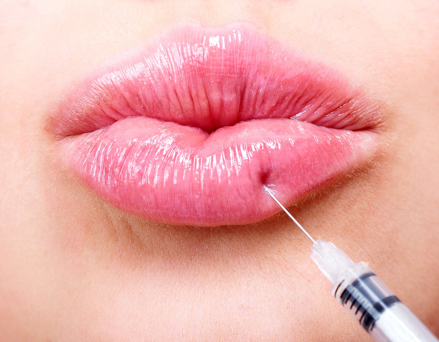 Lip Fillers Injections What Makes Them Effective
