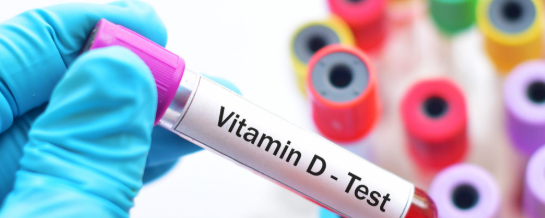 Vitamin D Test