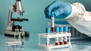 AR Laboratory Billing Services for Smarter Revenue | CareSolution