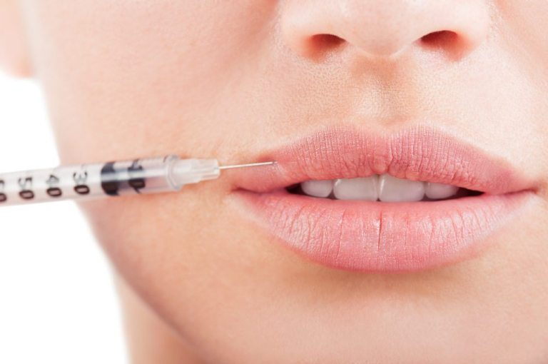 lip-augmentation