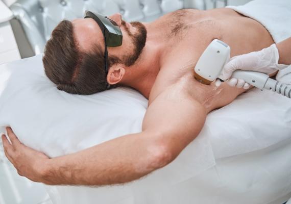 Laser Hair Removal for Men 4-5