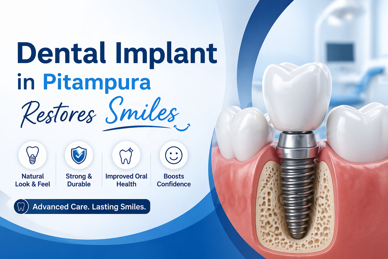 Dental Implant in Pitampura