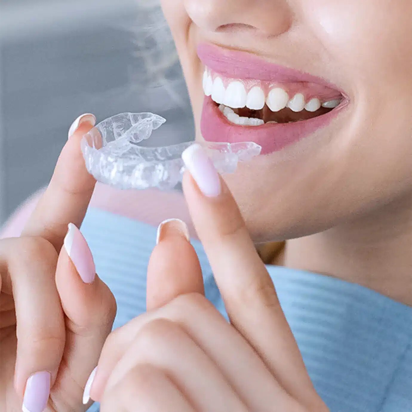 Invisalign in London